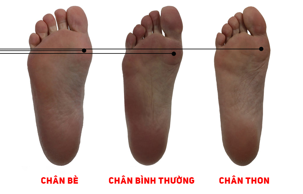 Phân biệt chân thon và chân bè